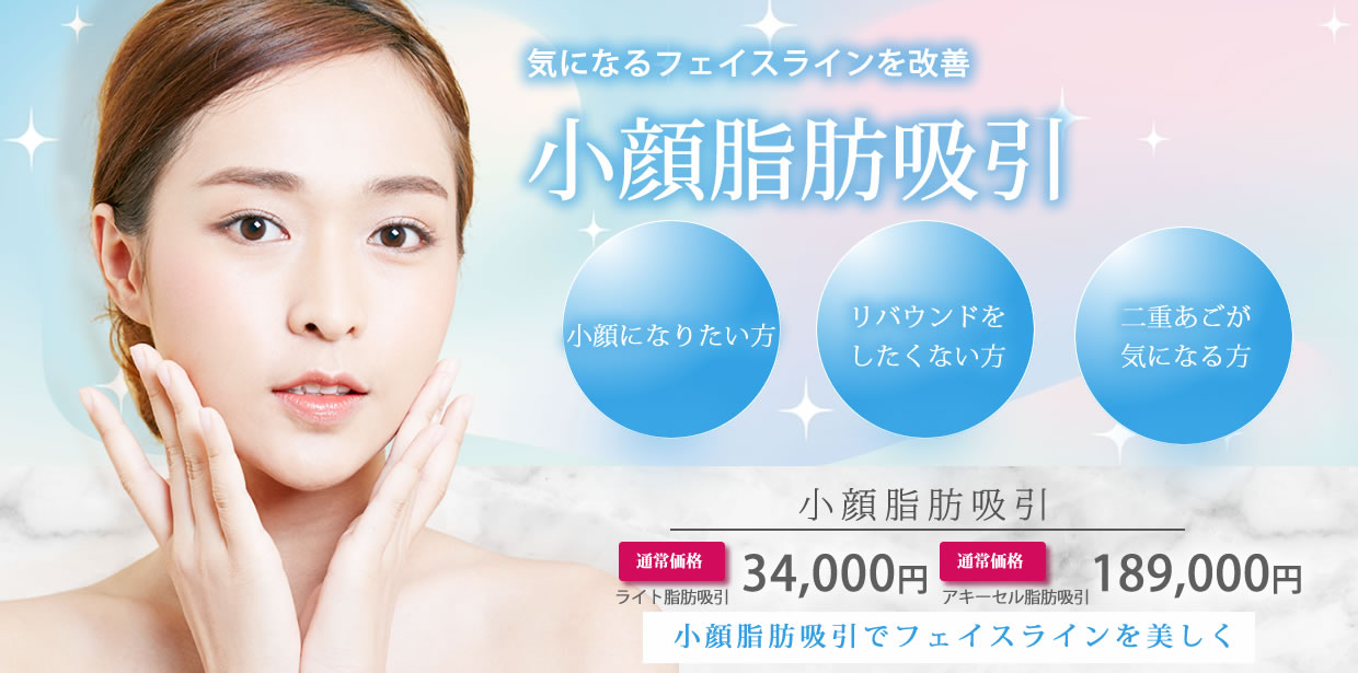 東京シンデレラ美容外科　小顔脂肪吸引　バナー