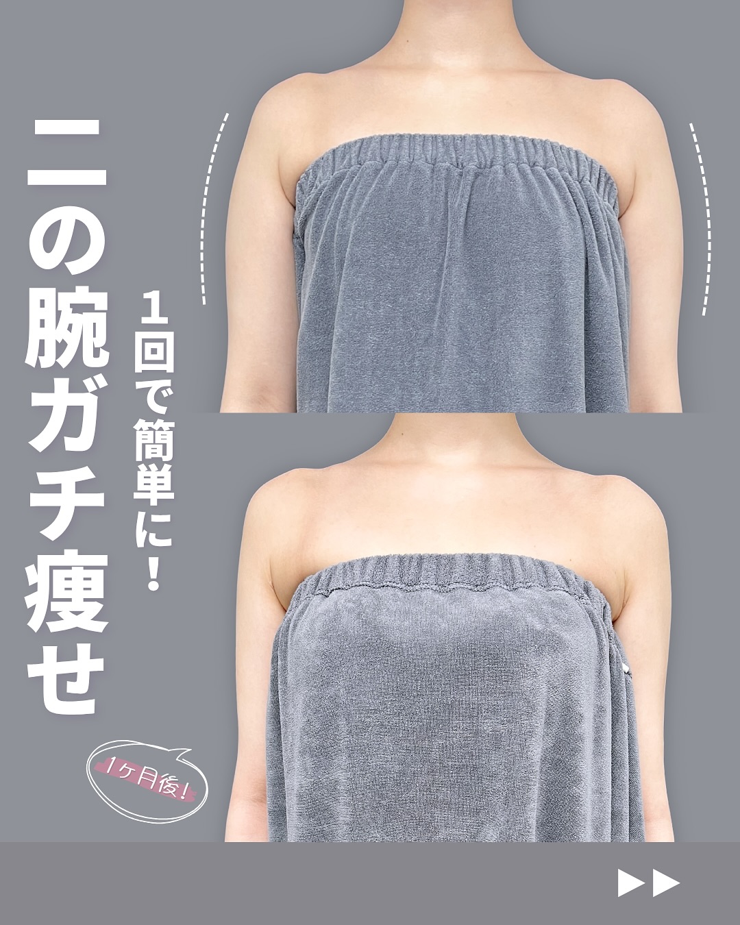 新宿院で行ったアキーセル脂肪吸引(二の腕・肩・副乳)の名医の吉原伯医師の症例写真