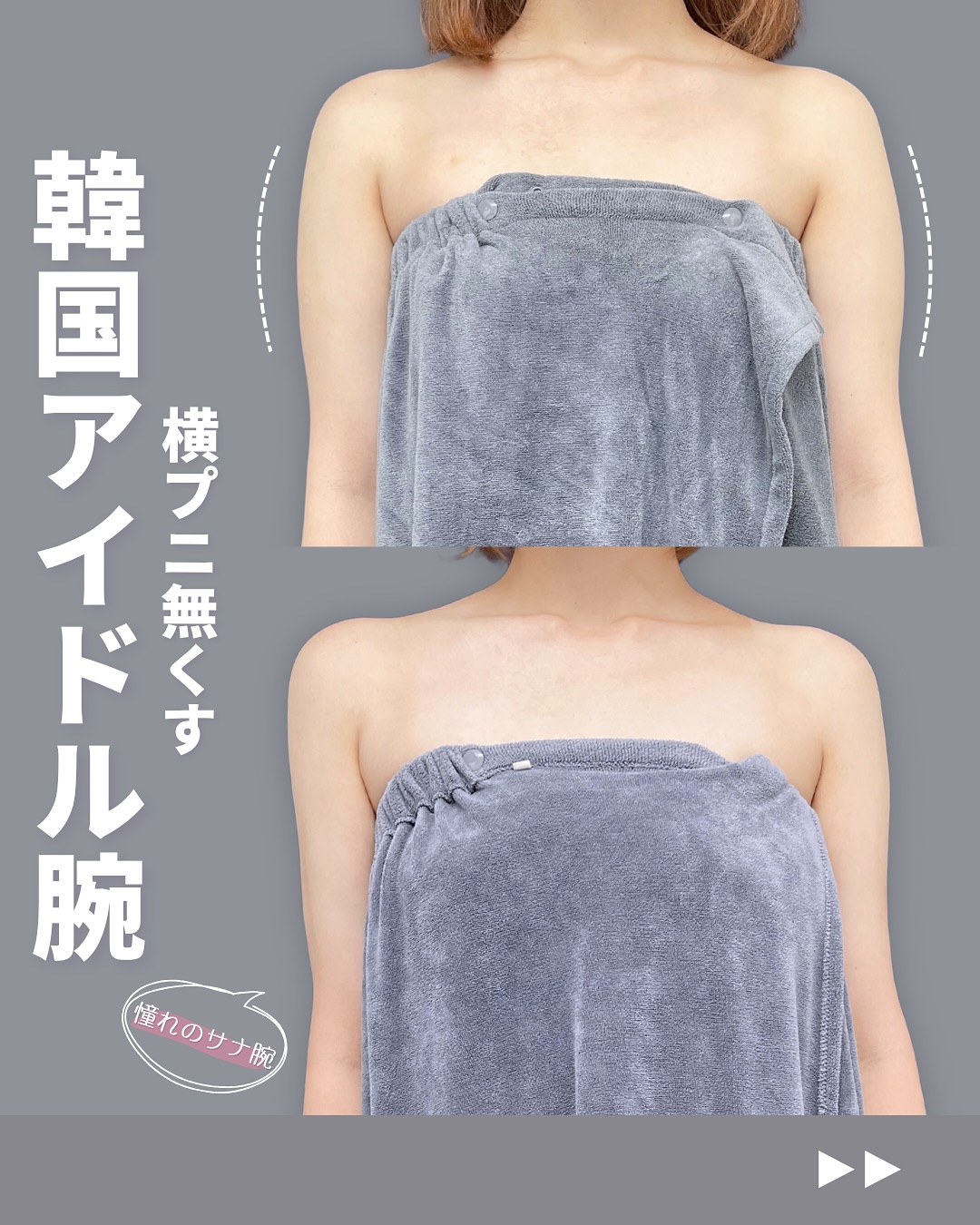 新宿院で行ったアキーセル脂肪吸引(二の腕・肩)の名医の吉原伯医師の症例写真