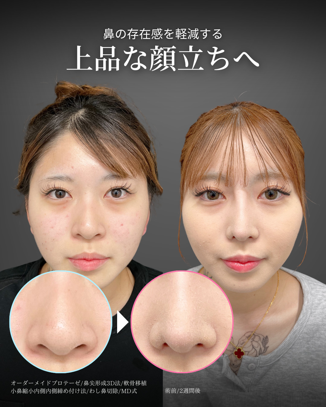 上品な顔立ちへ