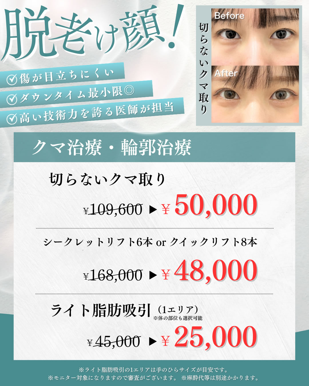 2025年11,12月キャンペーン クマ、輪郭形成