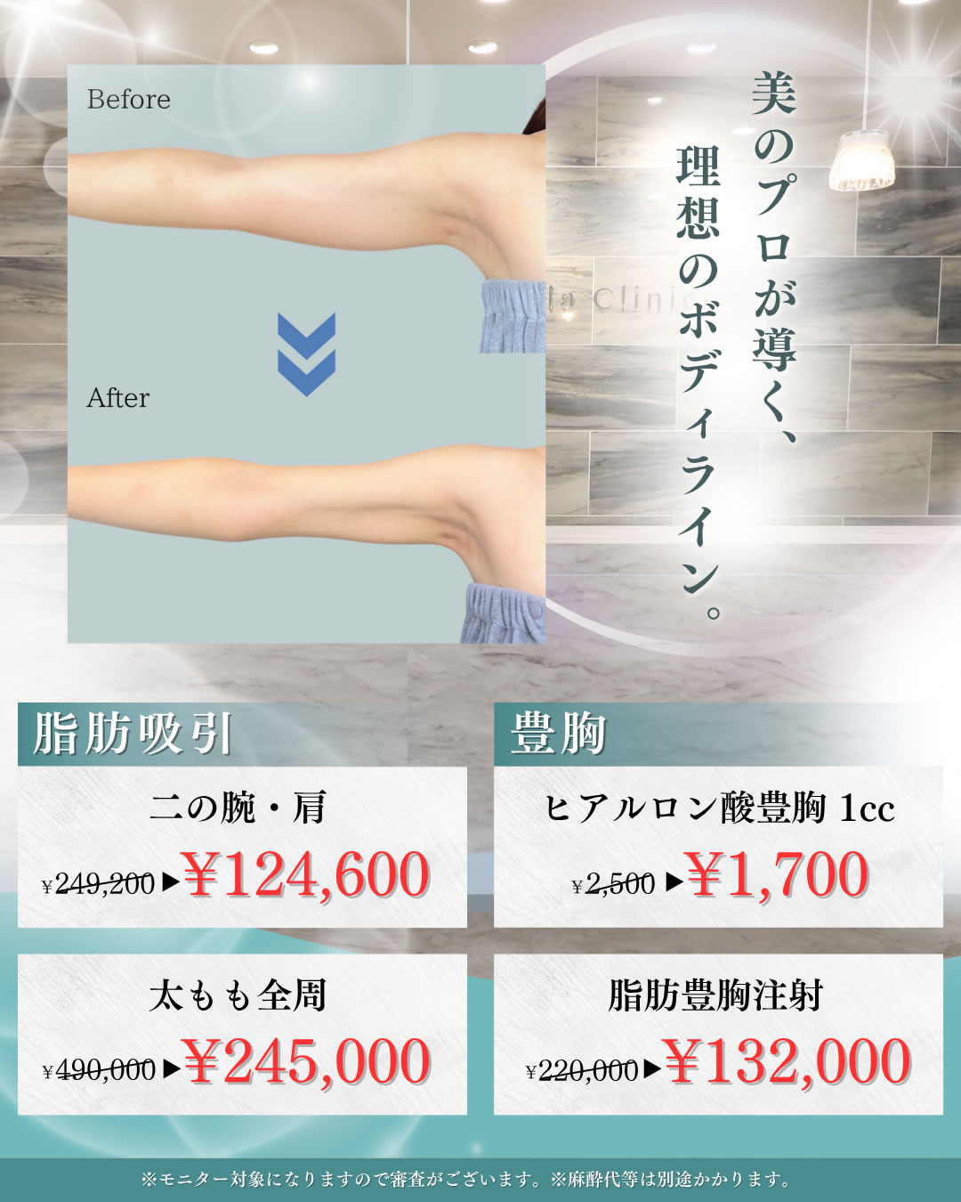 2025年11,12月キャンペーン 脂肪吸引、豊胸