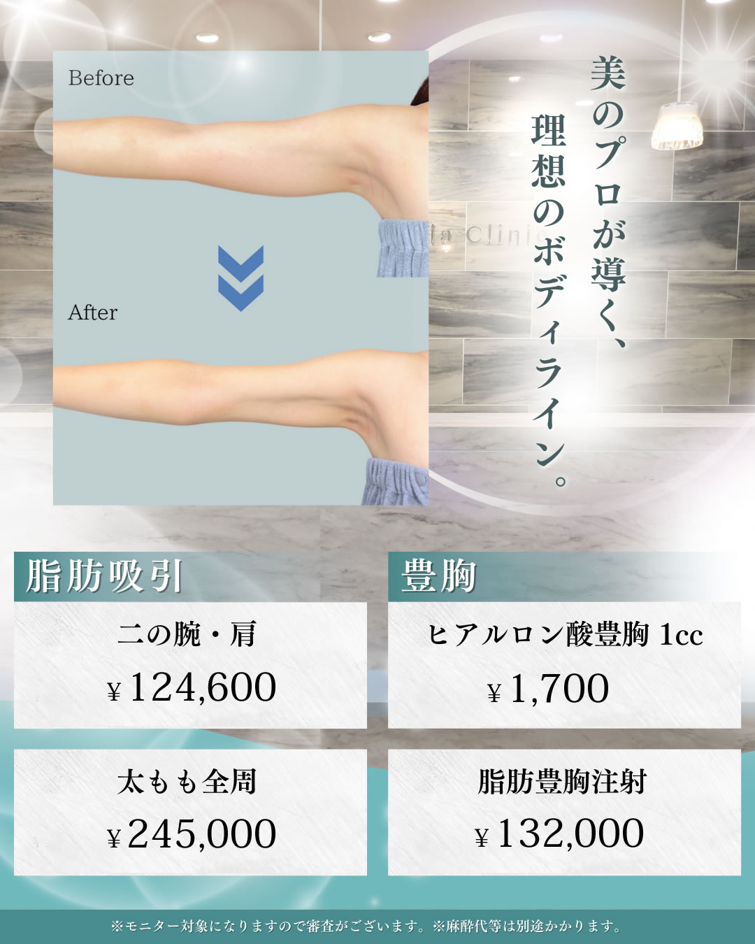 脂肪吸引キャンペーン