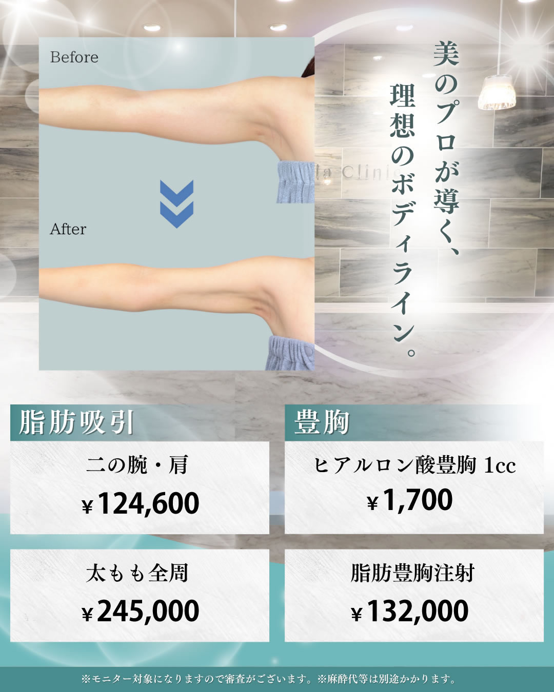 11.12月脂肪吸引、豊胸キャンペーン画像