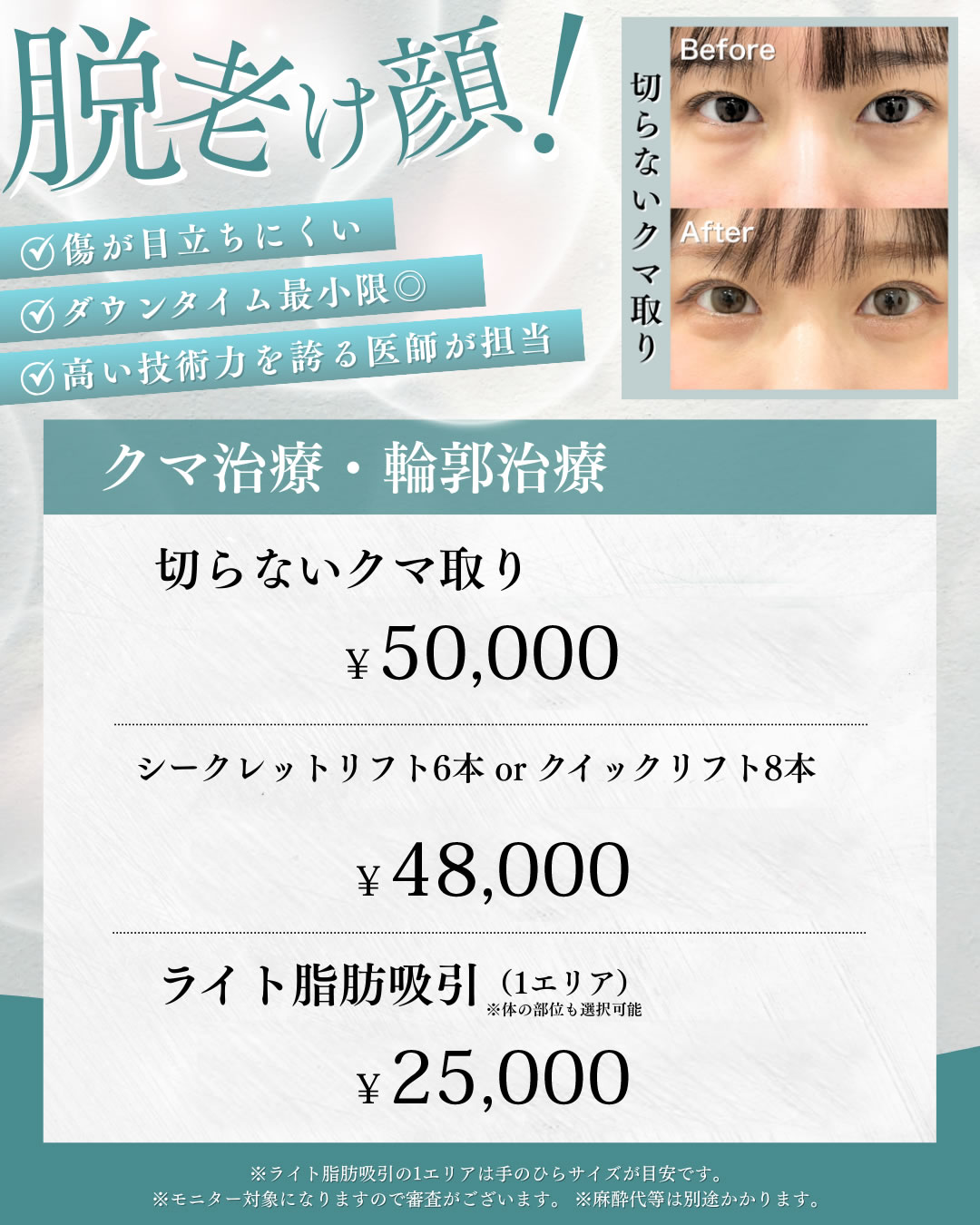 クマ取りキャンペーン