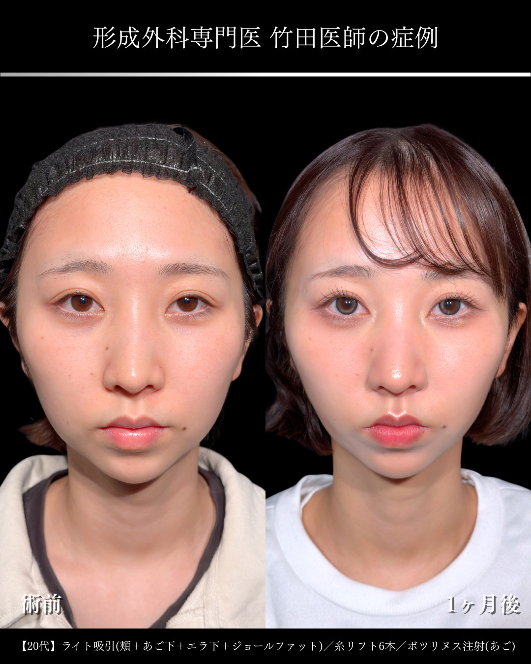 竹田 昌平 の症例写真一覧｜ 新宿・池袋・大宮・横浜で人気の美容整形