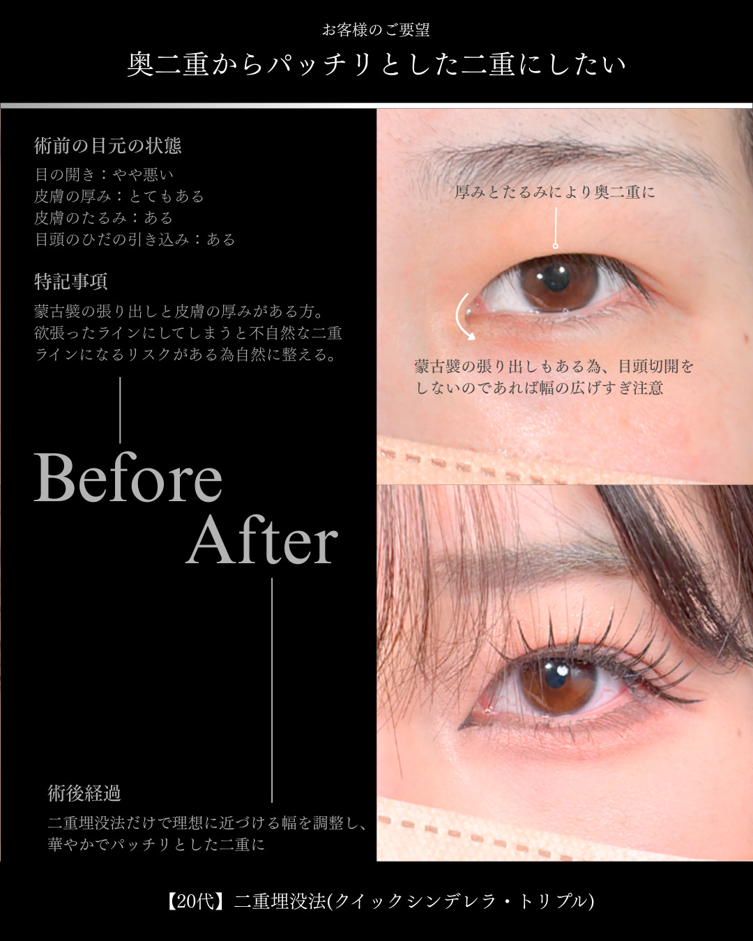 【中古】 夢をかなえる美容整形 カリスマ美容師が選んだ、ナチュラルな二重整形 | LA MER CLINIC