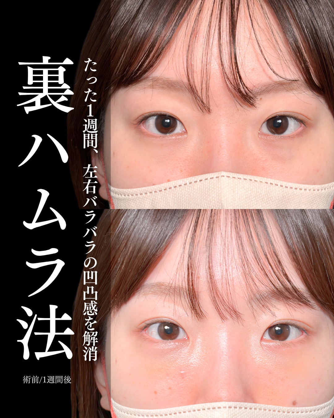 大宮院で行っ裏ハムラ法で有名な名医の竹田昌平医師の症例写真