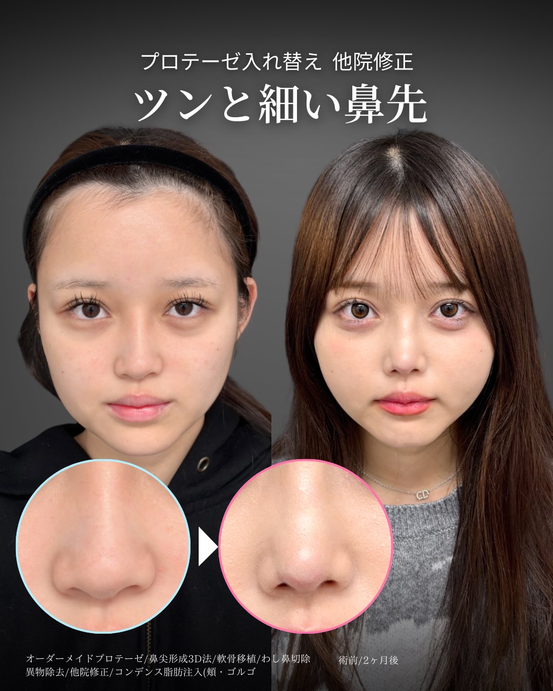 可愛い 鼻