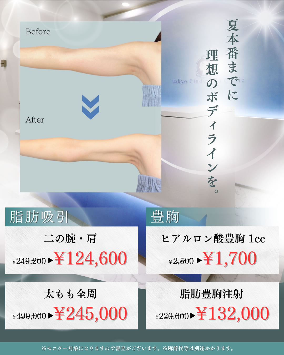 5,6月キャンペーン　脂肪吸引・豊胸