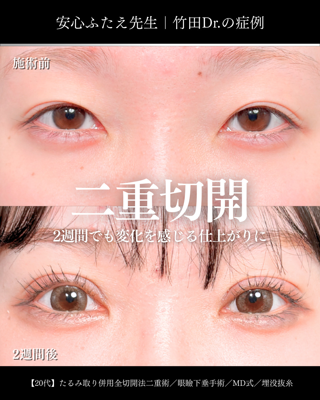 EYEeyelid surgeryセレクト美容塾・眼瞼　美容外科形成外科 眼形成外科 - 眼科専門書店 オー・ビー・エス online shop