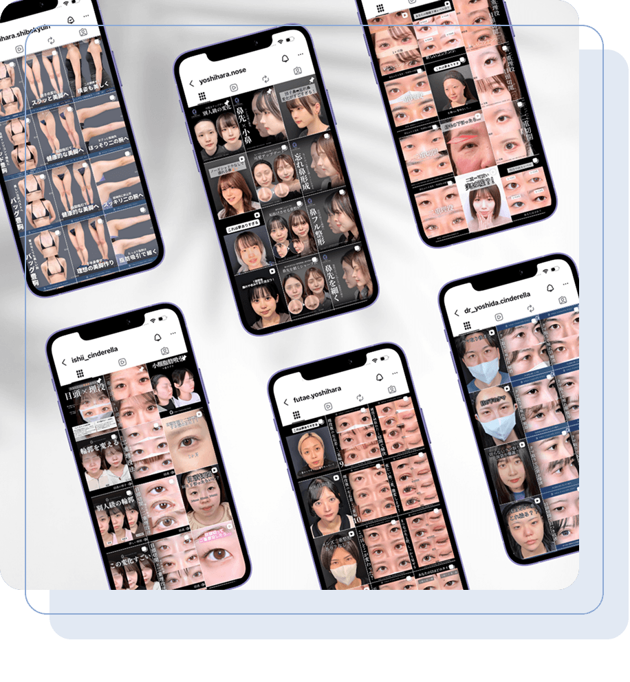 症例数が豊富だから理想の仕上がりが見つかる