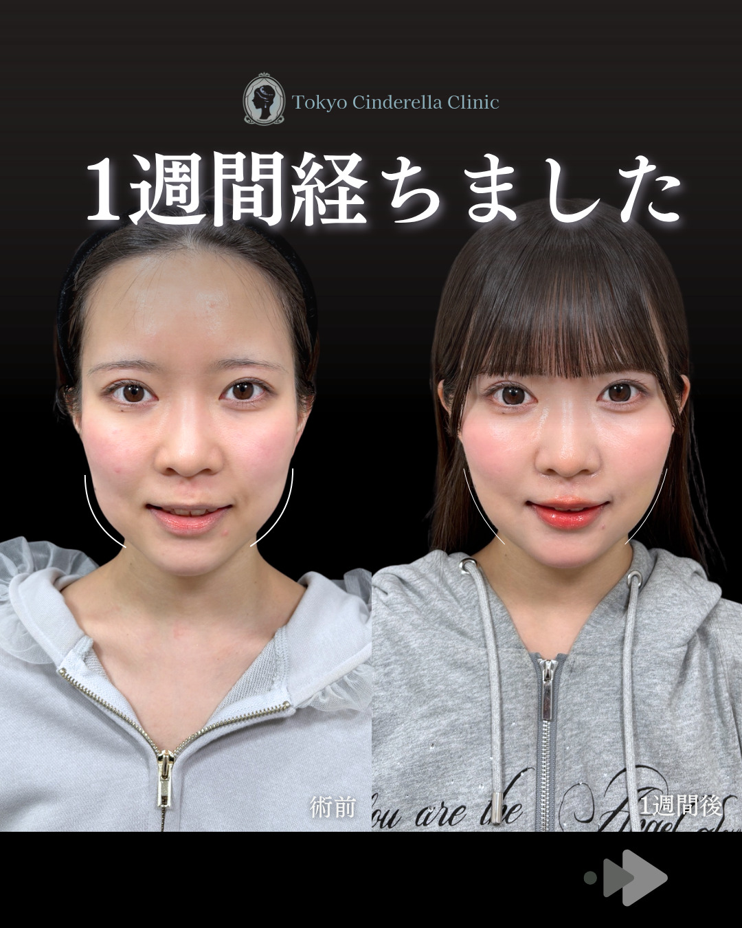 【中古】 美容整形を受ける人のために 2026年最新】Yahoo!オークション -#美容整形の中古品・新品・未使用品一覧