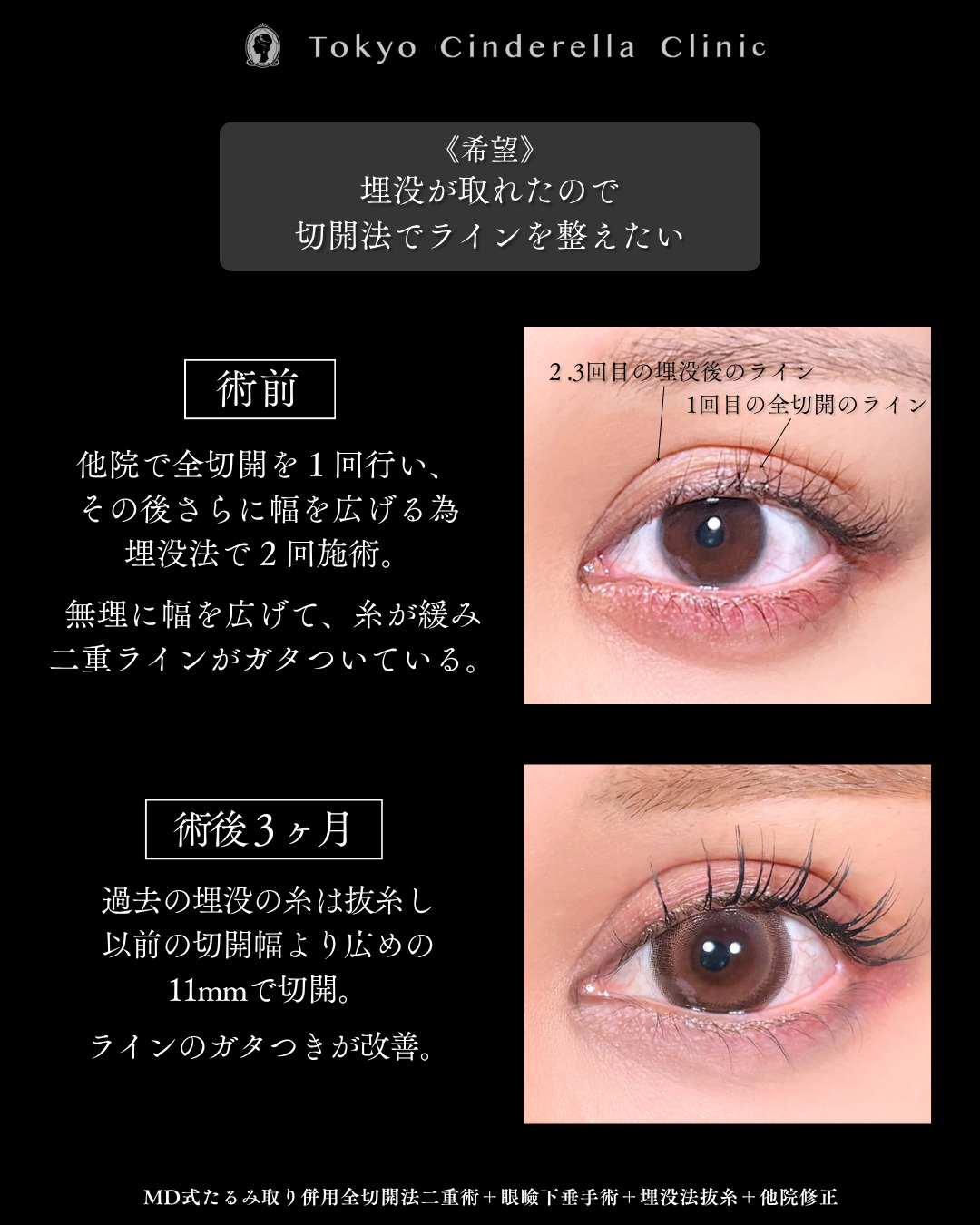 あご下スッキリ 」に関する美容整形の症例写真の詳細 | 新宿・池袋