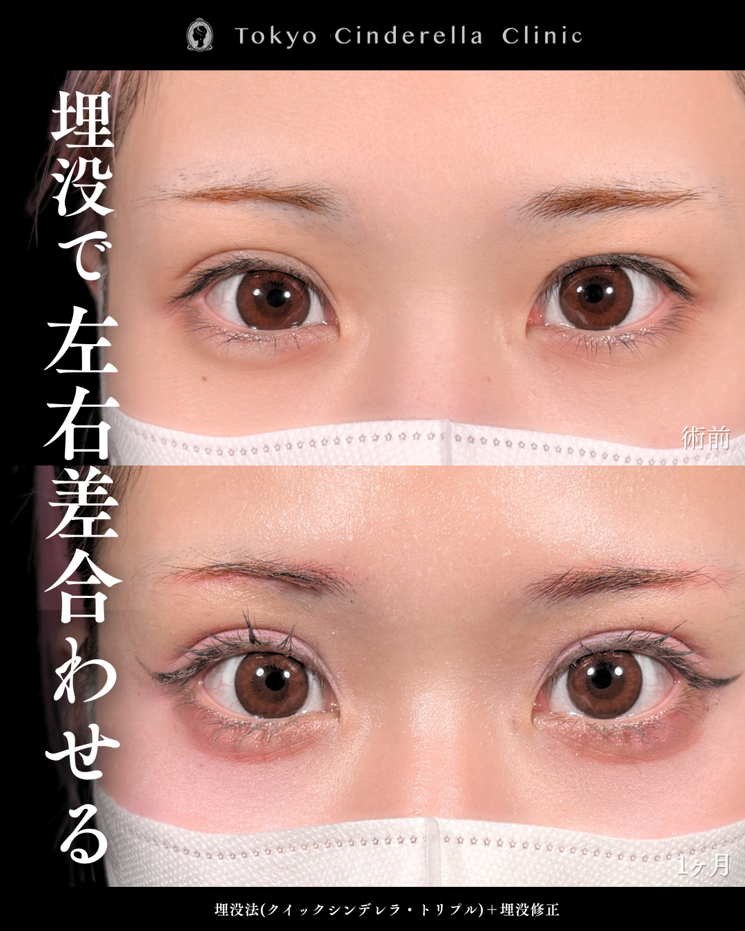 吉原 伯 の症例写真一覧｜ 新宿・池袋・大宮・横浜で人気の美容整形は